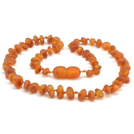 Baby teething amber necklace 5